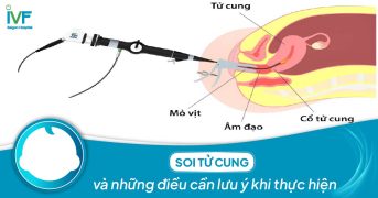 Soi tử cung và những điều cần lưu ý khi thực hiện