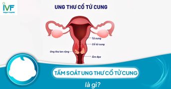 Tầm soát ung thư cổ tử cung là gì?