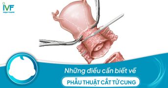 Những điều cần biết về phẫu thuật cắt tử cung